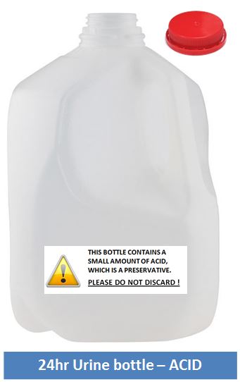 24-hour urine - ACID bottle